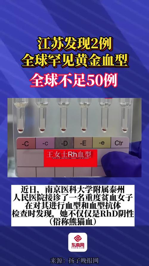 发现罕见黄金血型（江苏发现2例黄金血型）