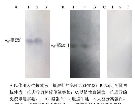 碱性乳白体是什么：碱性乳白体只有男生有